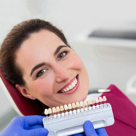 Dental Veneers in Westminster, CA