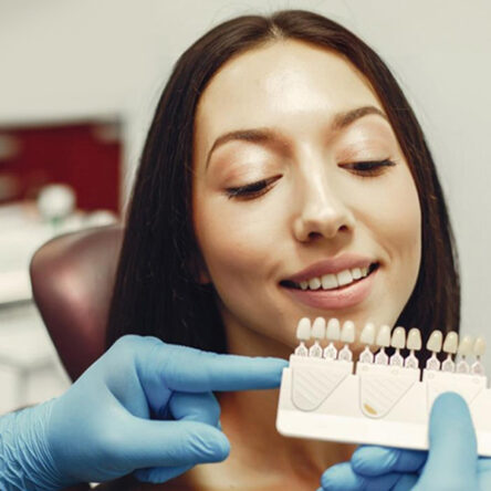 How Many Teeth Are Considered a Full Set of Veneers?
