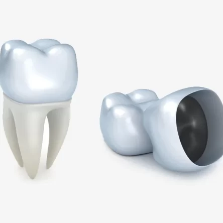 Need-a-Tooth-Fix-Fast-Everything-to-Know-About-Dental-Crowns-in-Westminster